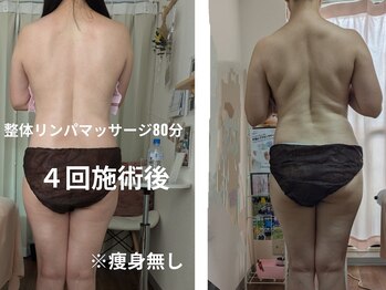 紬(TSUMUGI)/整体とリンパマッサージ