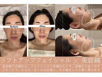 たかや鍼灸 整体院