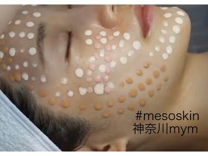 マイムー(mym)の写真