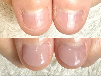 グラシナ なんば店/深爪/自爪育成/フィルイン