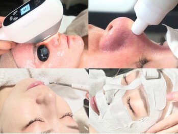 ビズビズ 梅田店(bisebise)の写真/new先行導入！話題の韓国式4施術【凸凹/毛穴開き改善】フラクショナル×ハイドラ洗浄×VC導入×白玉マスク