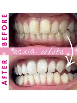 エクシアホワイト 倉吉店(ecxia white)/ビフォーアフター