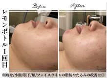 アリュール 倉敷(ALLURE)の雰囲気（ご予約枠拡大中◆レモンボトル半額祭☆3月末迄延長◆）