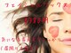 ビーデル(Wieder)の写真