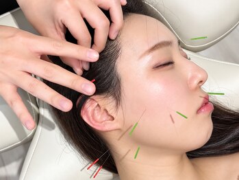 ビハリスト 麻布十番の写真/『美容鍼をもっと身近に』低価格で通いやすい美容鍼《初回割引あり》今以上の美肌習慣を当店で☆