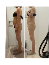 プラチナアース つくば店(Platinum earth)/痩身ビフォーアフター