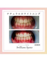 ブリリアント 京都店(Brilliant)/ナチュラルホワイトニング