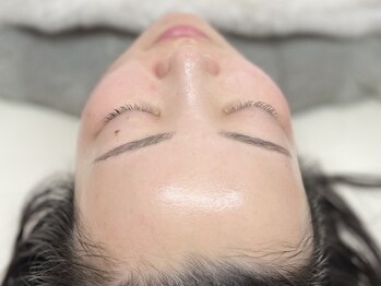 ウイ(u’i)の写真/[ハイドロ毛穴洗浄・艶肌Wax]お得な学割有り◎ヒト幹細胞培養液のお仕上げセットで毛穴悩みを根本肌質改善!