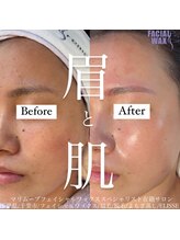 エリス(ELISSE)/眉と肌を整える、綺麗を叶える