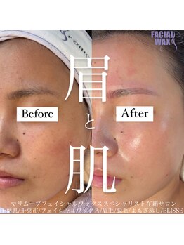 エリス(ELISSE)/眉と肌を整える、綺麗を叶える