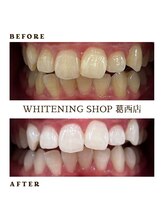 ホワイトニングショップ 葛西店/歯科提携 ホワイトニング専門店