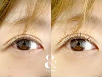 ムニ(muni)/&healthy【アンドヘルシー】