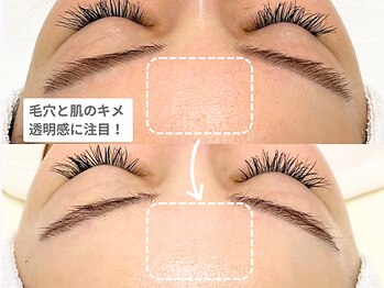 アンシャンテ 神戸元町店(Enchante)/毛穴洗浄ピーリングフェイシャル