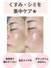 【痛み少ない◎】【シミケア１回コース】￥13,200→￥9,900円