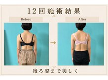 ネイト ワックス(Neit Wax)/後ろ姿まで美しく♪