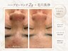 【9月末まで限定★毛穴・ニキビ集中ケア】REVIハーブ2g +美容液 1種+毛穴洗浄