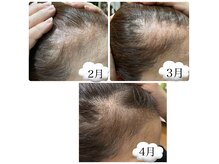 カレント(current)の雰囲気（8週間PGヘアケア商品！産後のお悩み/加齢によるお悩みに◎）