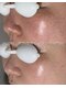 アンドエフ(&F)の写真/アンストレス＋IPLで【肌の土台作り】をし、揺らぎにくい肌へ。