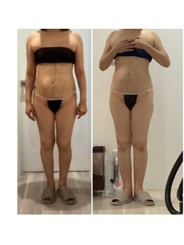 プラチナアース つくば店(Platinum earth)/痩身ビフォーアフター