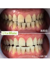 ルブラン 奈良店(Le Blanc)/50代男性のお客様