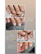 ミニマル(minimal)/自爪育成