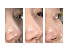 バイオラックスビューティー 大塚店(BIOLUXE BEAUTY)の雰囲気（根本からの改善を。症例写真はフォトギャラリーをご覧ください）