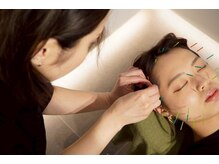 ルーロ サロン(LooLo salon)の雰囲気（【鍼灸施術を受けたい】鍼とお灸で深部まで本気の肌質改善！）