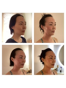 スパ 香炉/フェイシャル