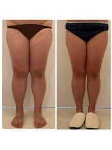 美人バスト 浜松店/【バストを残してダイエット★】