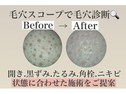 スイ(sui)の写真