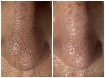 サラグランデ(Sara Grande)/お客様のお声