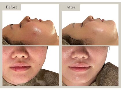 リスタ(RSTA)の写真