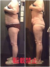 プラチナアース つくば店(Platinum earth)/痩身ビフォーアフター