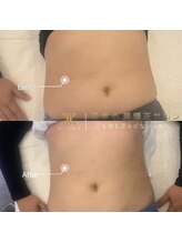 美骨矯正サロン メディカルカイロテルボ 高田馬場店/【肋骨締め・骨盤締め】（痩身）