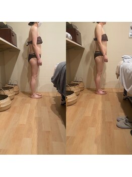 トトノエル(TOTONOEL)/姿勢矯正筋膜リリース