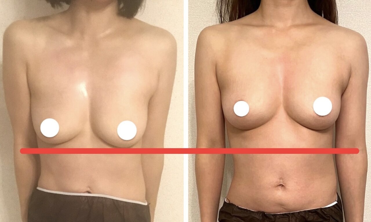 【産後バストにハリと弾力】見惚れるバスト！産後育乳特別ハンドマッサージ