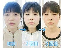 ストレッチヒーロー 出雲店(STRETCH HERO)/むくみ・首回りもスッキリ