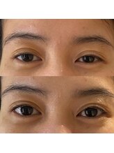 リアプア(Li'a)/ぱっちりな目元へ　眼精疲労