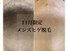 《11月脱毛キャンペーン》メンズの爆抜けヒゲ脱毛!人気No.1!