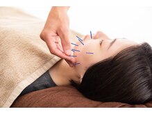 ハリッシュの雰囲気(美容鍼現役講師が行うワンランク上の美容鍼)