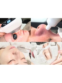 美白ケアをしたい