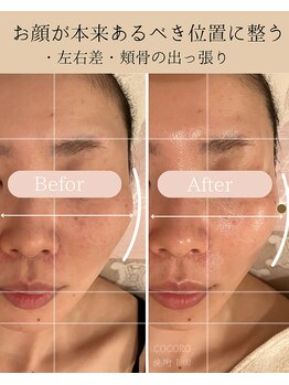 ココロ(COCORO)/頭もお顔も小さくなるエステ1回