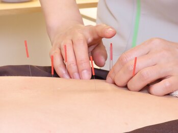 ジョンファ目黒鍼灸院/美容鍼＆身体のもみ鍼灸 90分/2