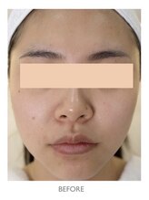 myura/ハイアルチューン　ビフォー