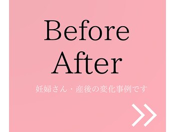 ルーナサナ(Luna sana)/