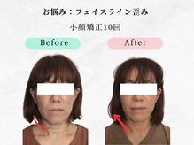 美容整体 ウェリナ 蟹江院/小顔矯正/骨盤矯正/痩身整体