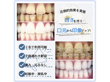 歯のホワイトニング専門店の写真