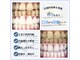 歯のホワイトニング専門店の写真