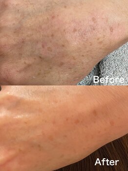 シュシュエステプリューム(Chou Chou Esthe PLUME)/