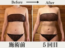 リウル(RiUll)/凹凸が出る腹筋へ